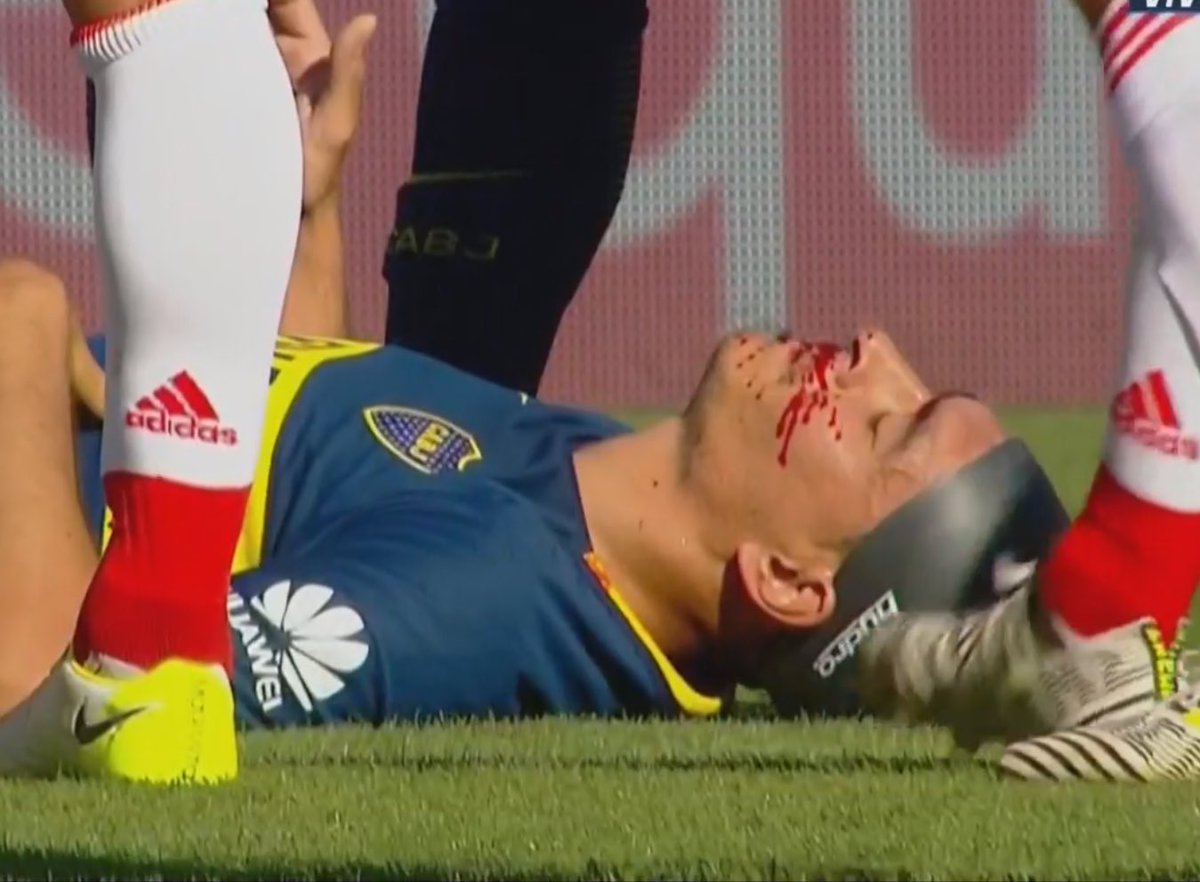 capochabostero's tweet photo. #El2DeBoca https://t.co/lhIgYcrtcR