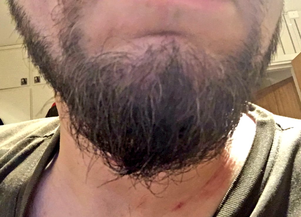 awmperry's tweet photo. @CISimonNelson What a day for my wife to say "Isn't it time you trimmed your beard a bit?" #YouCallThatTufty #PerfectBeard #WorldBeardDay https://t.co/WUHPrFGFcc