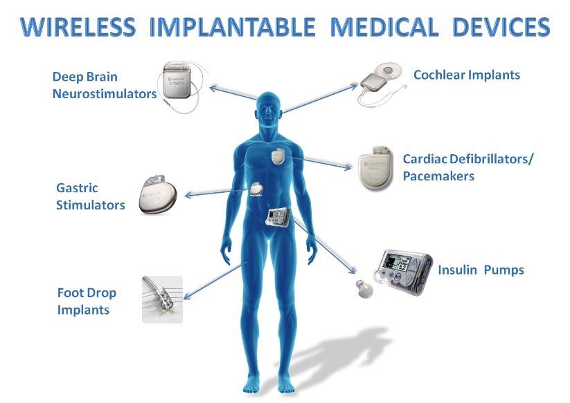 Michael81082's tweet photo. #Cybersecurity isn't just about data #security it's also a matter of life and death! #Infosec #Cyberattacks #MedicalDevices #CISO #HealthIT https://t.co/UeymBN0LDf