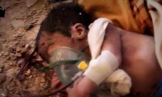 LeodagniM's tweet photo. aviones franceses bombardearon hospital de neonatos en siria y nadie dice un coño, marditos gringos y complices https://t.co/mk8iw19ceP