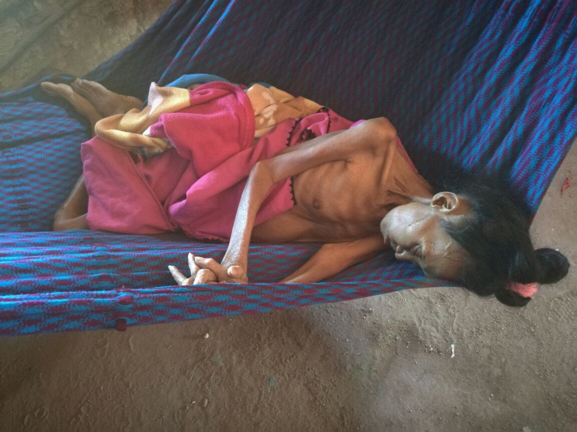 petrogustavo's tweet photo. Esta señora wayúu muere de hambre en la Guajira. Este modelo de salud que mata y solo es negocio debe terminar. La salud es un derecho https://t.co/jyVwXMC4Lg
