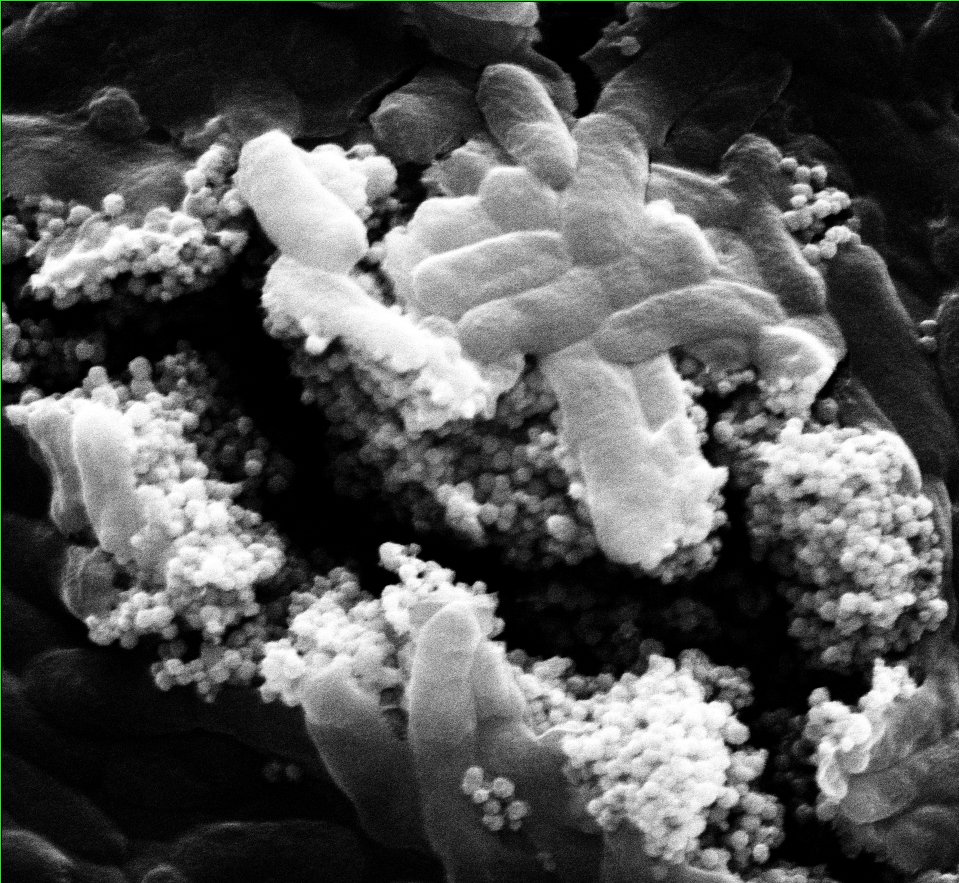 NanoOrbitNews's tweet photo. #Nanoparticle clusters can kill infectious bacteria found in water treatment systems @RiceUNews https://t.co/RjY0zceJoX https://t.co/XKGGfxPs9x