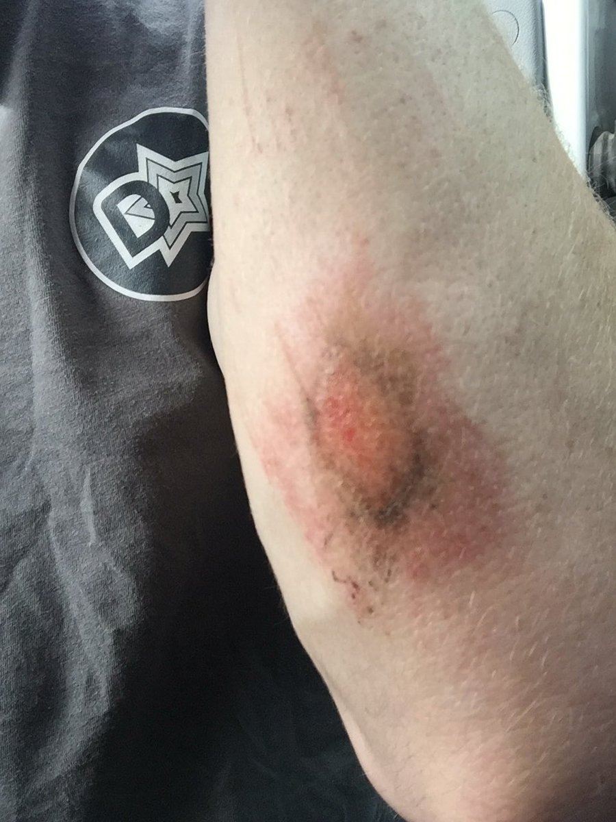 James Shanes 󾓪 tweet media