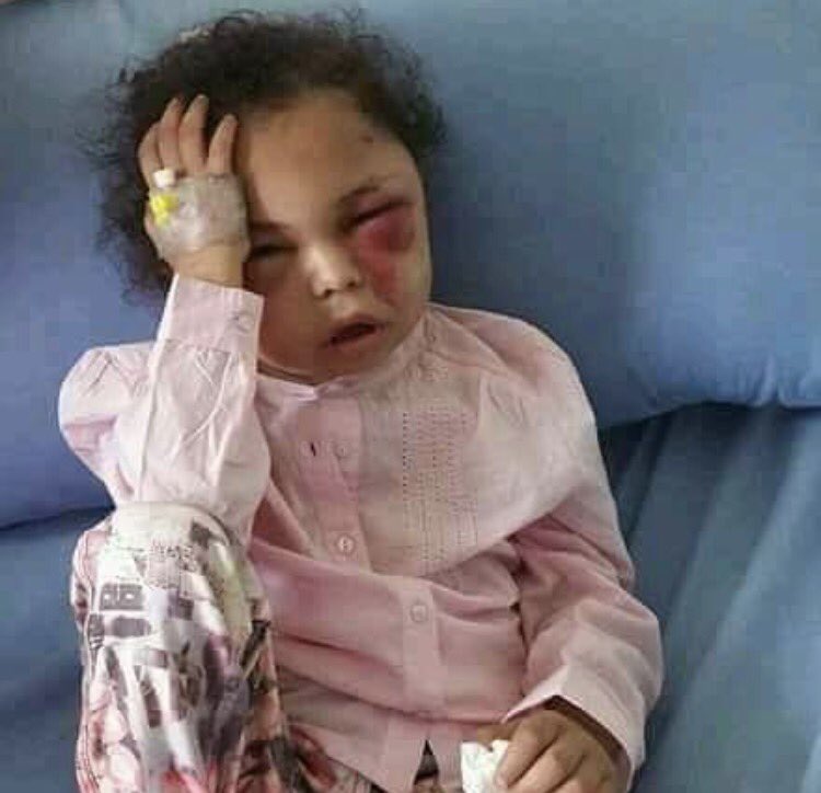 AhmedHamed49749's tweet photo. الطفلة بثينة وأسرتها نموذج لحقوق
المرأة على الطريقة الأمريكية .
#امريكا_تقتل_المرأة_اليمنية
#OrangeTheWorld
https://t.co/RkAVHC1vJU