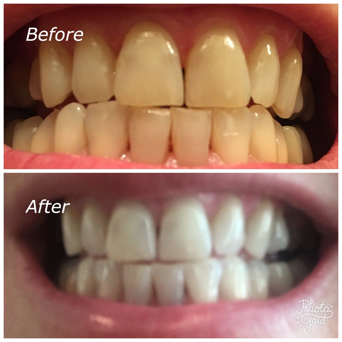 rula_berg's tweet photo. Wow! I just cant get over the result from this toothpaste!😁20 bucks to change your smile I have magic toothpaste on hand! I will hook you up https://t.co/ubUpoYMewm