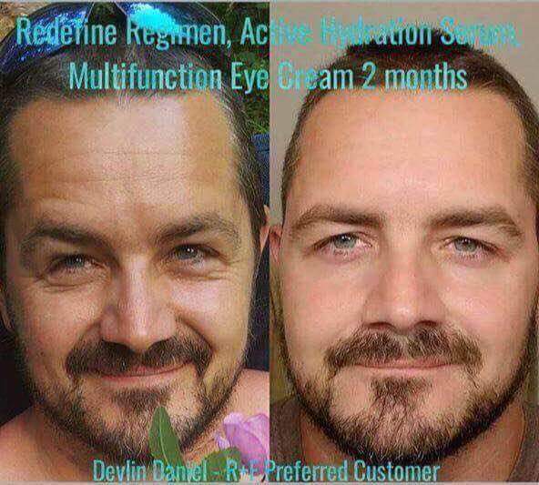 LisaArnesen1's tweet image. Life changing skincare backed with a 60 day money back guarantee! 
lisaarnesen.myrandf.com 
#lasflawlessfinish 
#rfvirtual