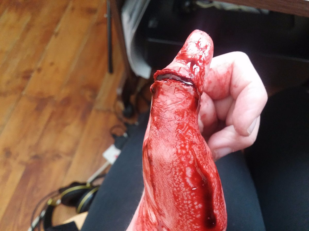 Sliced thumb with <a href="/bennyemakeup/">Ben Nye Makeup</a> nose and scar wax and <a href="/KryolanUK/">Kryolan UK</a> <a href="/KryolanOfficial/">Kryolan</a> HD blood #sfx #gore #blood #sfxmakeup #mua
