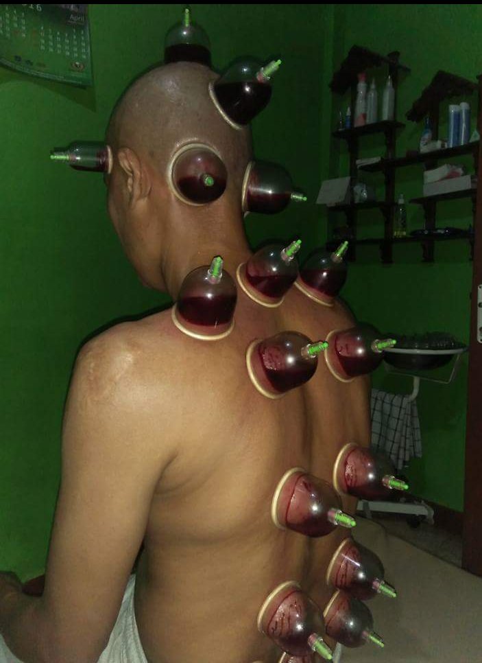 Fartigo &amp; Rabun ( Insyaa Allah ) tertolong sembuh