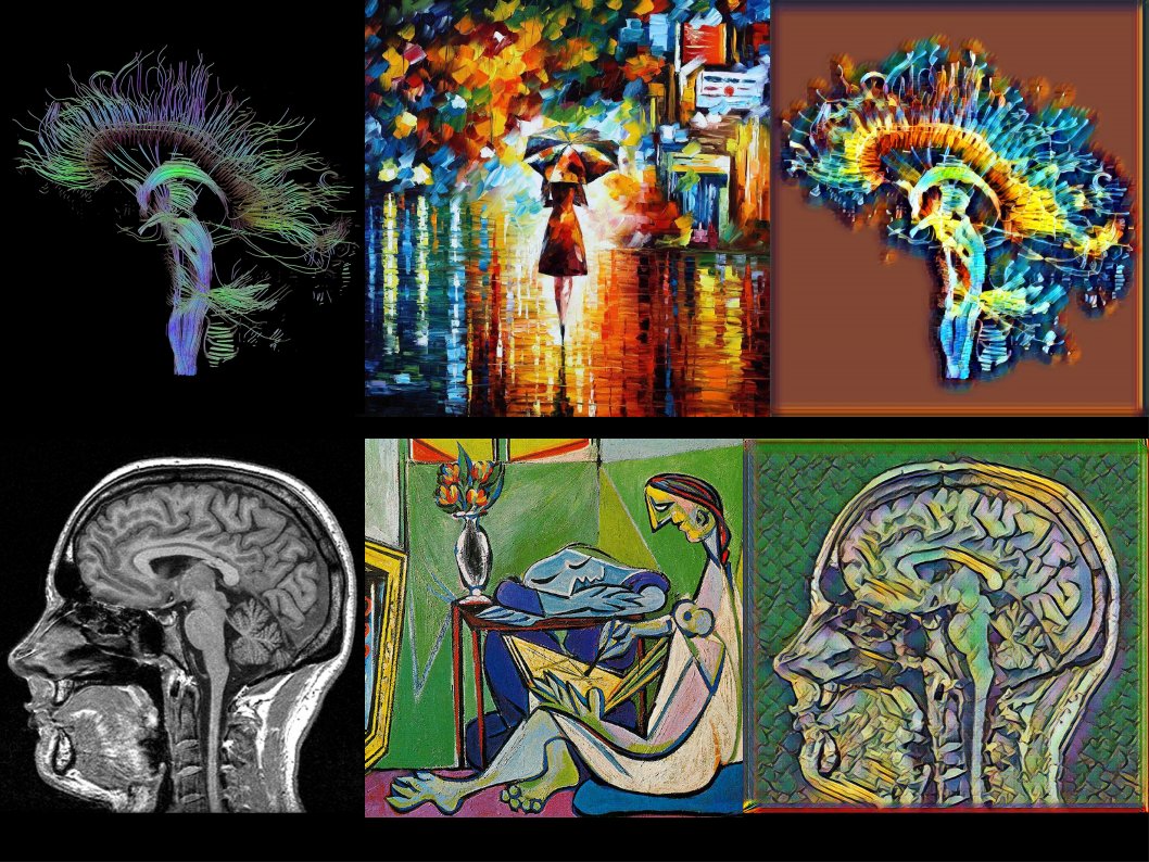 Deep Learning, Medical Imaging, and Arts
MR Tractography, Rain Princess (Leonid Afremov), artificially created image.linkedin.com/feed/update/ur…
