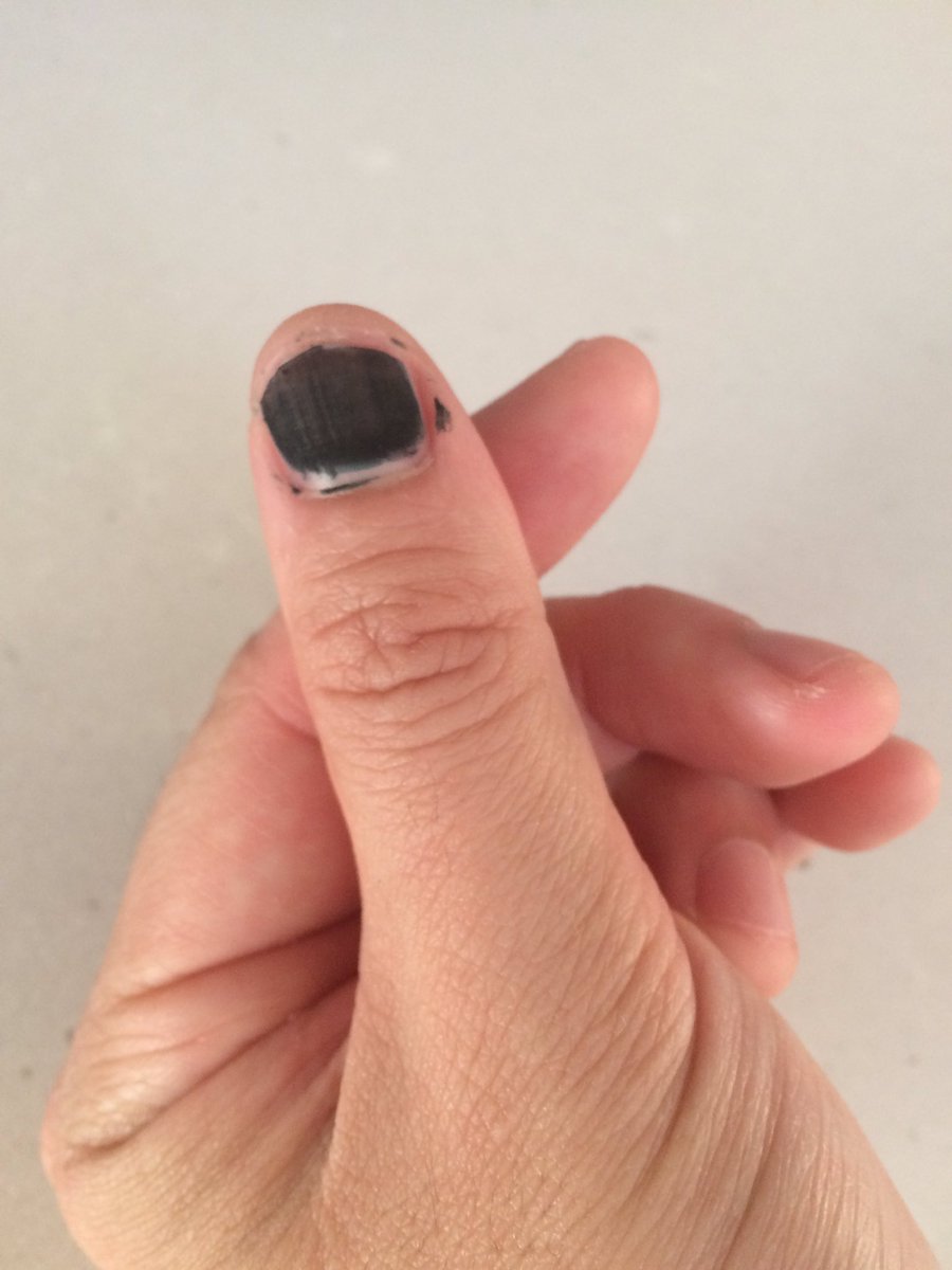 MichHiiELF's tweet photo. #SuperJunior #SuperJuniorIsComing #UNICEFBlackNail #GoodHeartedNail If @siwonchoi has done it, we all can do it too. 👀⬇️ https://t.co/77f73rOgNV