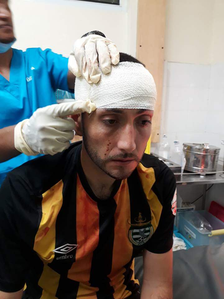 Bola_Manado's tweet photo. Brutalnya Liga Timor Leste. Pemain asing klub Karketu FC, Antonio Vega dikeroyok pemain lawan saat laga pamungkas lawan Zebra FC. https://t.co/axMOppYxly