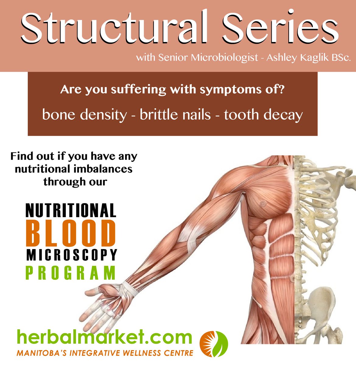 theherbalmarket's tweet photo. Are you suffering with #symptoms of #BoneDensityLoss #BrittleNails #ToothDecay https://t.co/CrFUJxcGQ7 https://t.co/HMEVPUTVqC