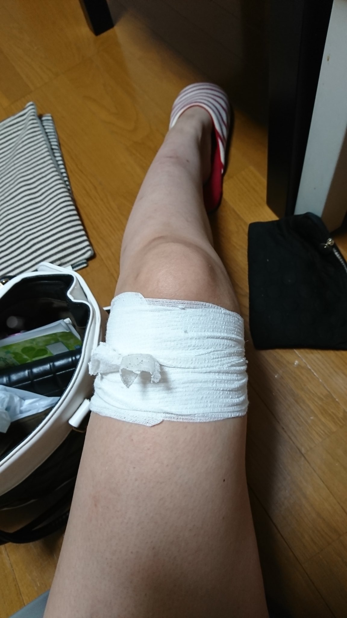 O Xrhsths えり 3y 1y Sto Twitter 怪我したのー 笑 火傷 みたいな感じ 包帯ぐるぐる 膿んでしまって治らなかったら病院行く 怪我 膿んでる 包帯 グルグル T Co Pout2i7oc0 Twitter