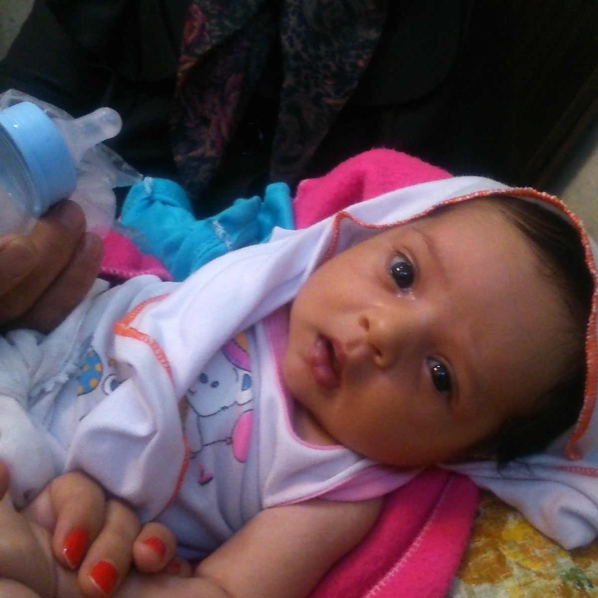 MalahatAhmadi's tweet photo. How can treat this 14 days baby without exercise therapy? 
#save_exercise_therapy_for_Iranian_physiotherapists https://t.co/iaFvvxGLGI