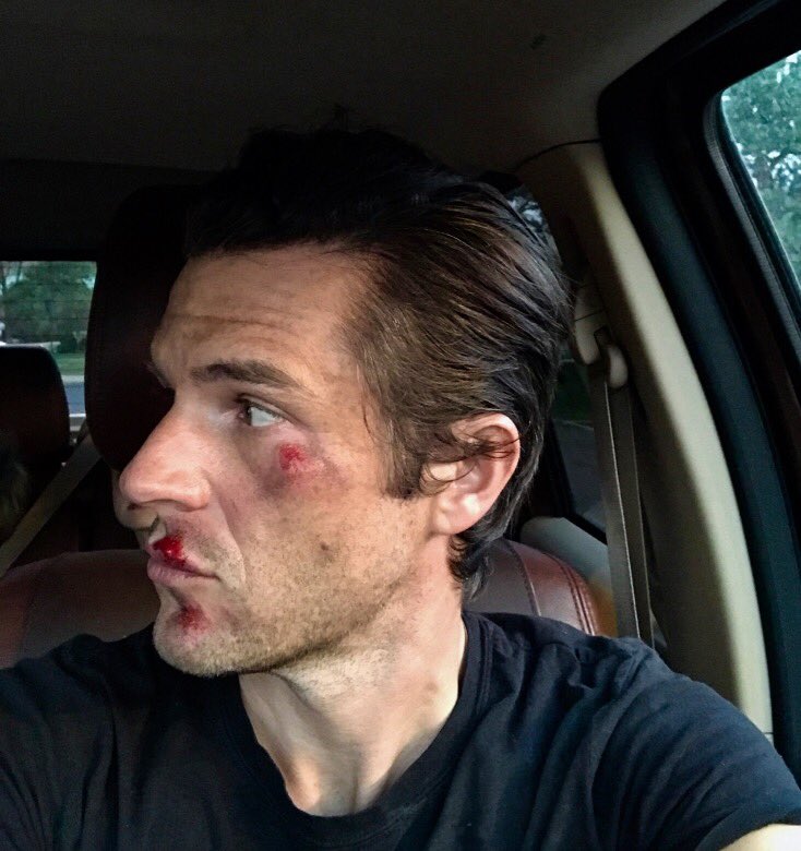 When mtn biking down hill, don't squeeze left brake.