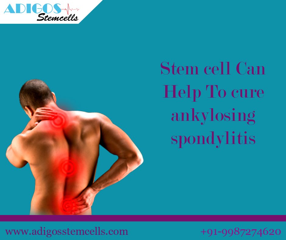 AdigosStemCell's tweet photo. #Stemcells can help to cure #AnkylosingSpondylitis https://t.co/cEckmnFf3V