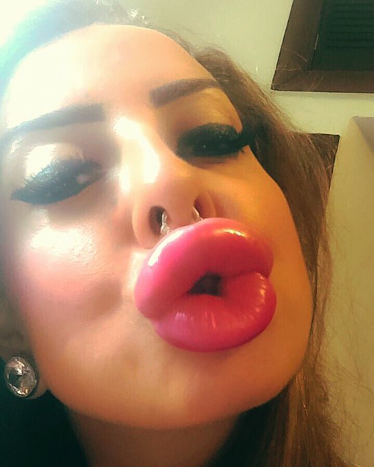 I pumped up yesterday my lips to 10cc now!👄💉#barbie #doll   #bimbo #implants #plasticperfection #porn<a href="/tag/barbie"class="tags">#barbie</a><a href="/tag/sex"class="tags"><span>#sex</span></a><a href="/tag/doll"class="tags"><span>#doll</span></a><a href="/tag/porn"class="tags"><span>#porn</span></a><a href="/tag/boobs"class="tags"><span>#boobs</span></a><a href="/tag/fuckdoll"class="tags"><span>#fuckdoll</span></a><a href="/tag/bimbo"class="tags"><span>#bimbo</span></a><a href="/tag/implants"class="tags"><span>#implants</span></a>