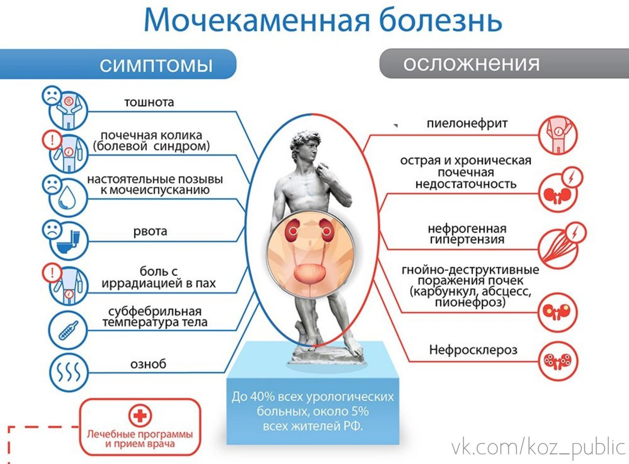 Осложнения при мочекаменной болезни почек