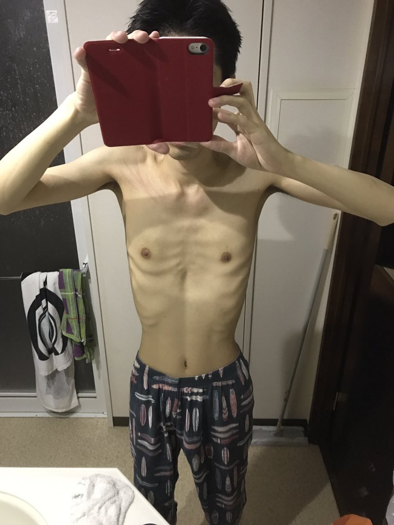 Horse Deer 閲覧注意 身長175cm体重45kgの体型がこれです 18歳のときは54kgあったのですが ここまで落ちました 顔面も大概ですけど 1番のコンプレックスはこの体型ですね 少しずつでも変えようと思うので 気持ち悪いですがupしておきます