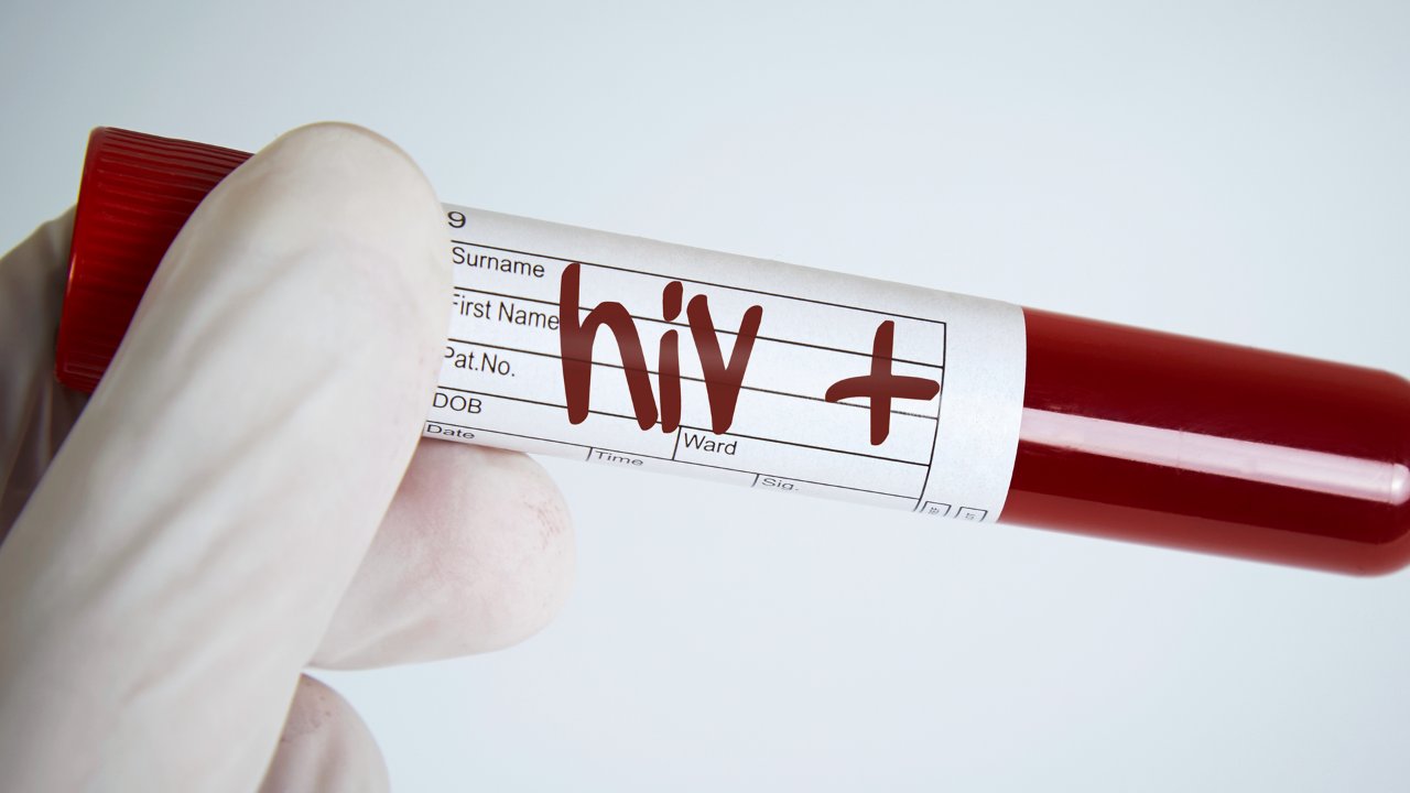 How long does it take for HIV to appear after infection? How long does it take to donate blood for HIV? 