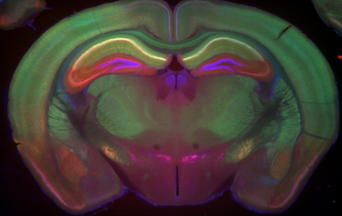 BrainsRus's tweet photo. Fun on the Axiozoom today! https://t.co/Mrv5Jvr03Y