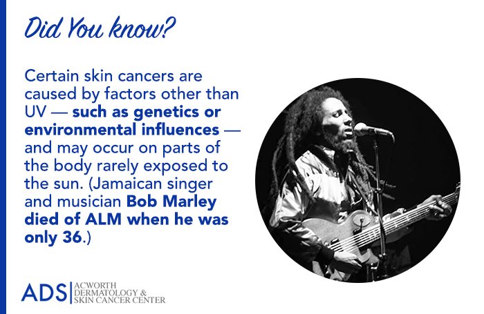 Certain skin cancers are caused by factors other than #UV such as #genetics or environmental influences. #skincancer #ALM #BobMarley