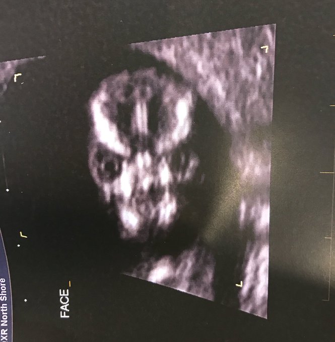 View image on Twitter