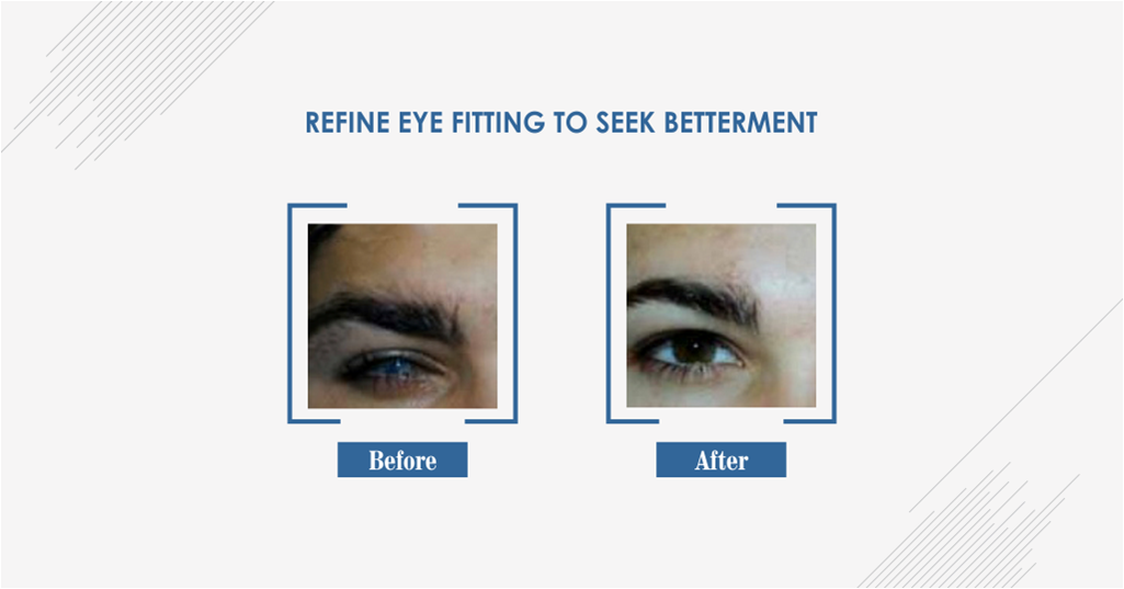 debrajshome's tweet photo. When to comes to artificial eye fitting, always choose the best as dissimilar eyes can decrease your confidence #FalseEye #Vision https://t.co/Z02ENzkVF6