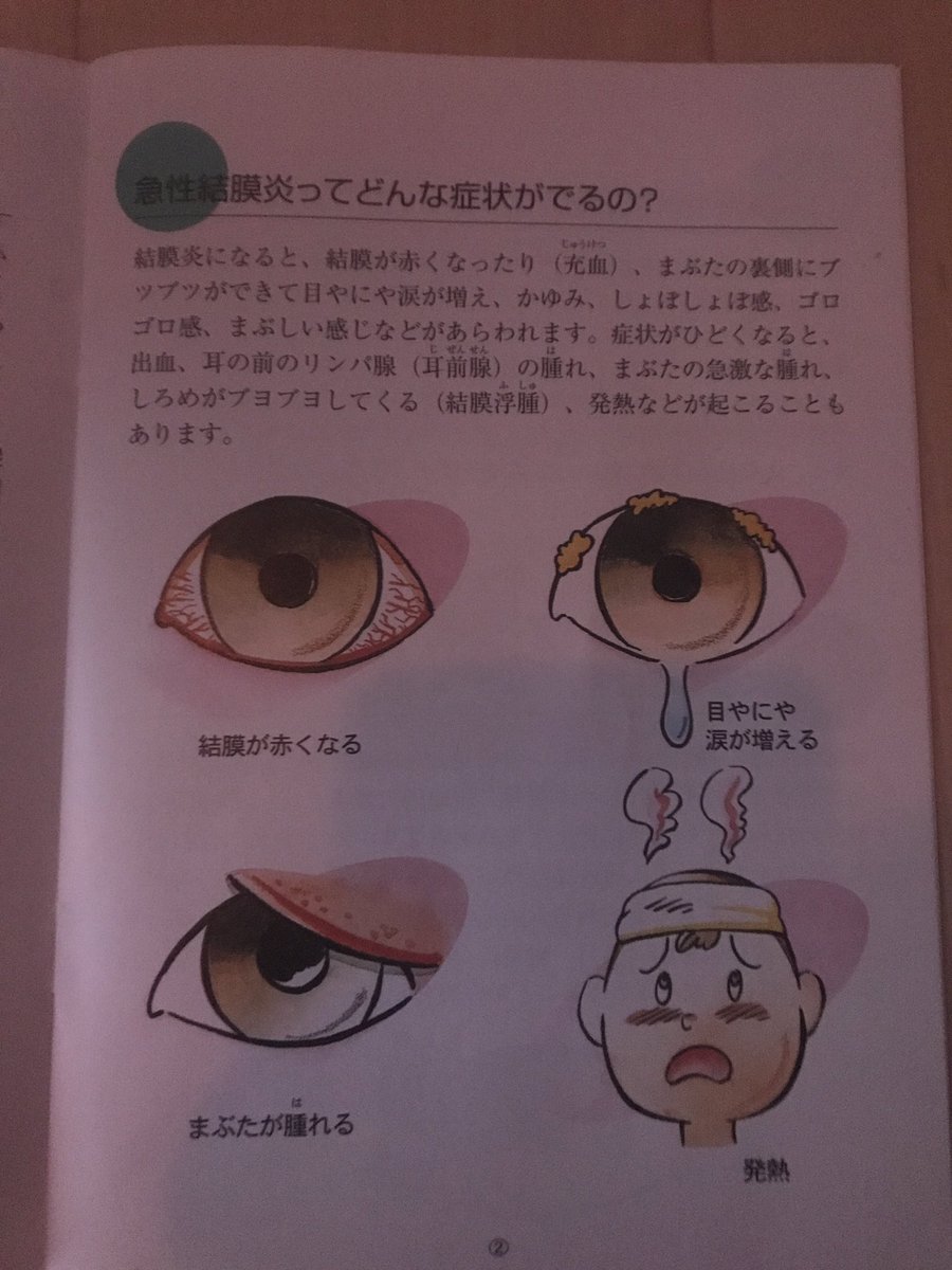 s58_'s tweet image. 勝手に涙がでてパンパンに腫れてます。体もだるい おわ。