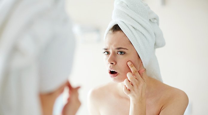 SivilceKremi_'s tweet image. Sivilce Nedir, Sivilceden Nasıl Kurtulunur? sivilcelekekremi.com/sivilce-nedir-… #sivilce #sivilcekremi #sivilceler #akne