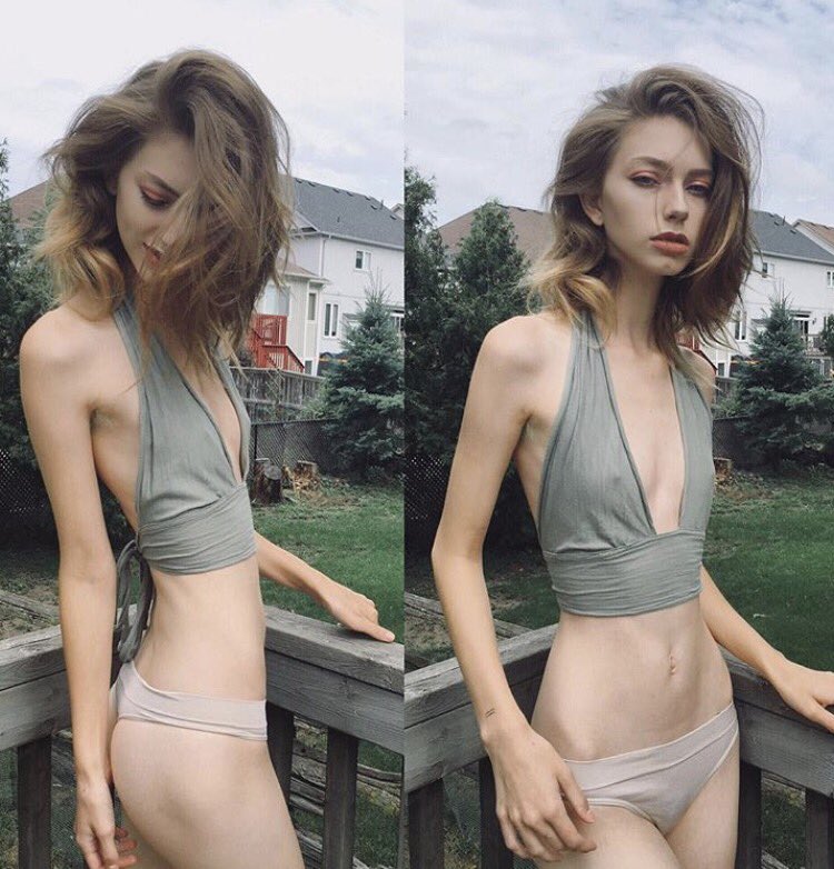 Jude Karda #thinspo #bonespo (g) .