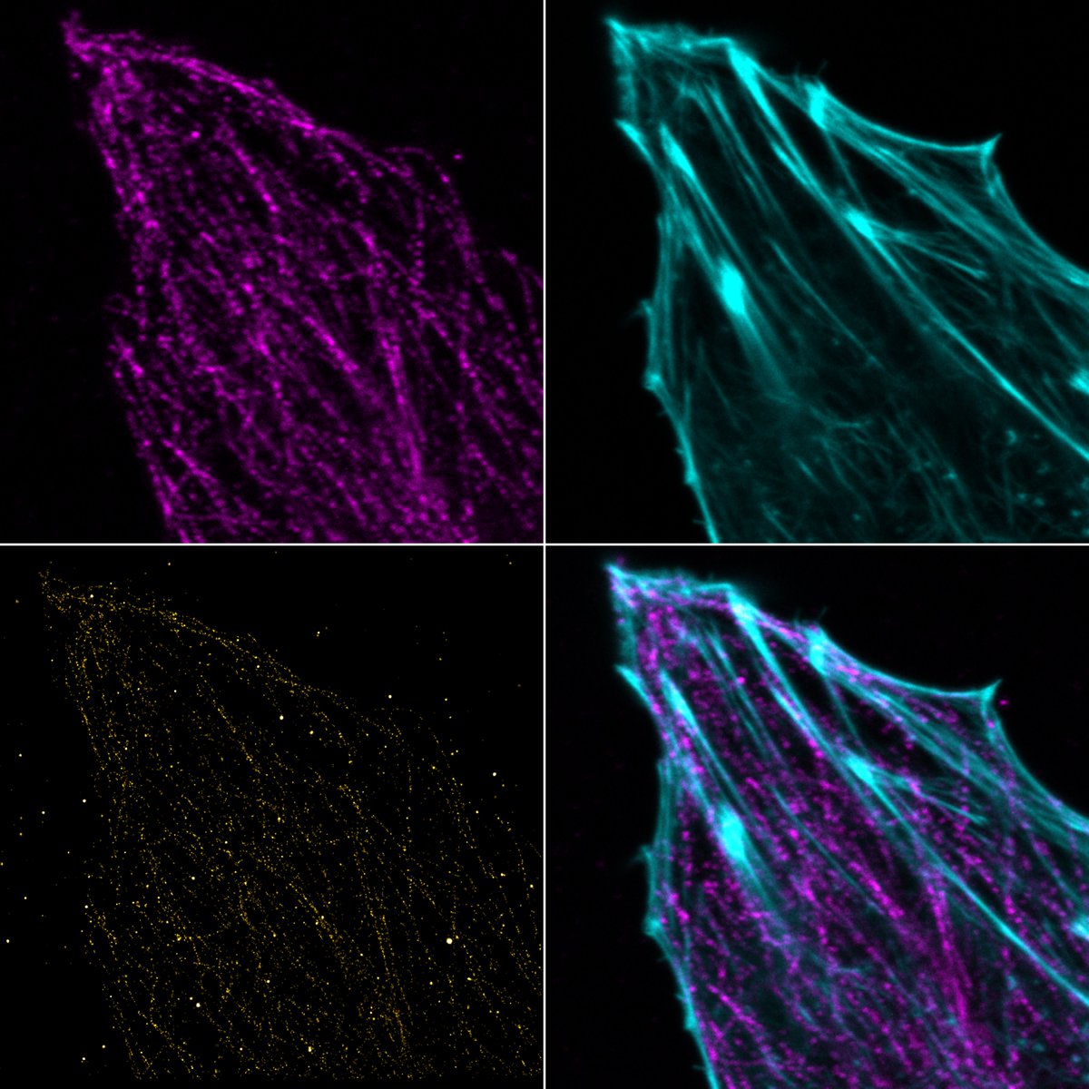 mrpaulreynolds's tweet photo. First ๐ฌ task after #SMLMS2017 was just to cave and image microtubules. Classic labelling density fail
cc @seamus_holden https://t.co/t90tvdejsh