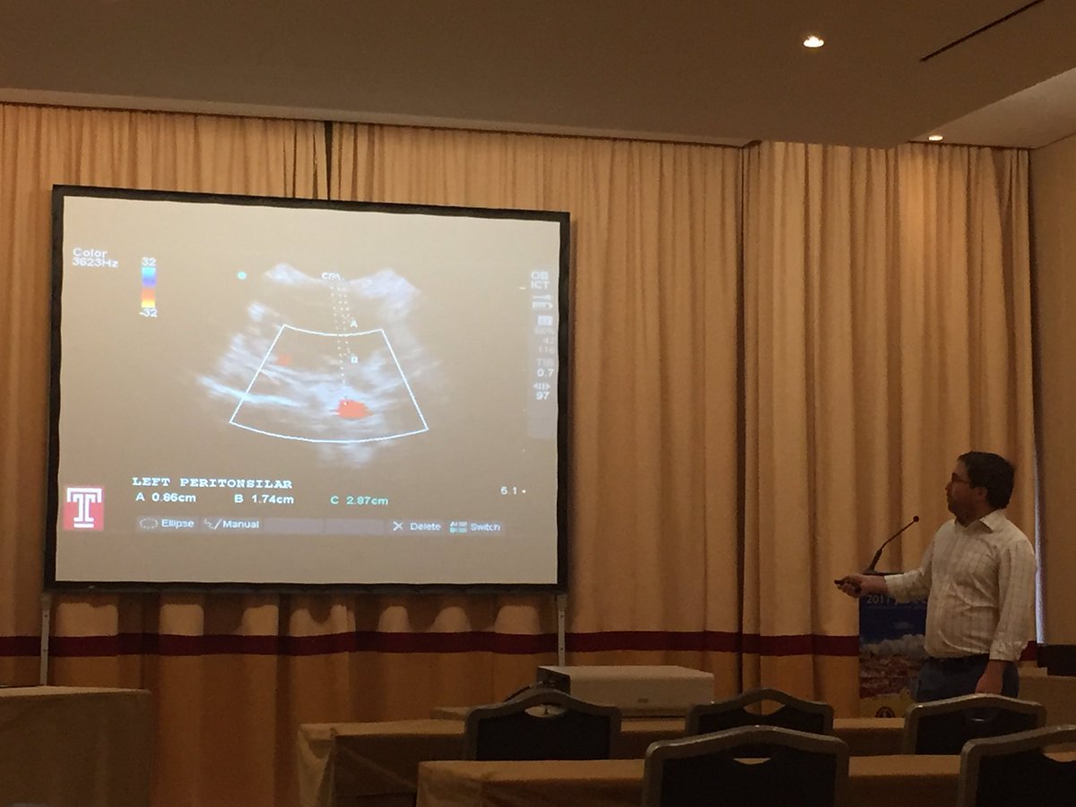 @ryangibbonsEMUS says ultrasound those PTAs-avoid CT, increase successful aspiration rate, decrease ED LOS <a href="/TempleEM/">Temple EM Residency</a>US @TempleEM #MEMC17