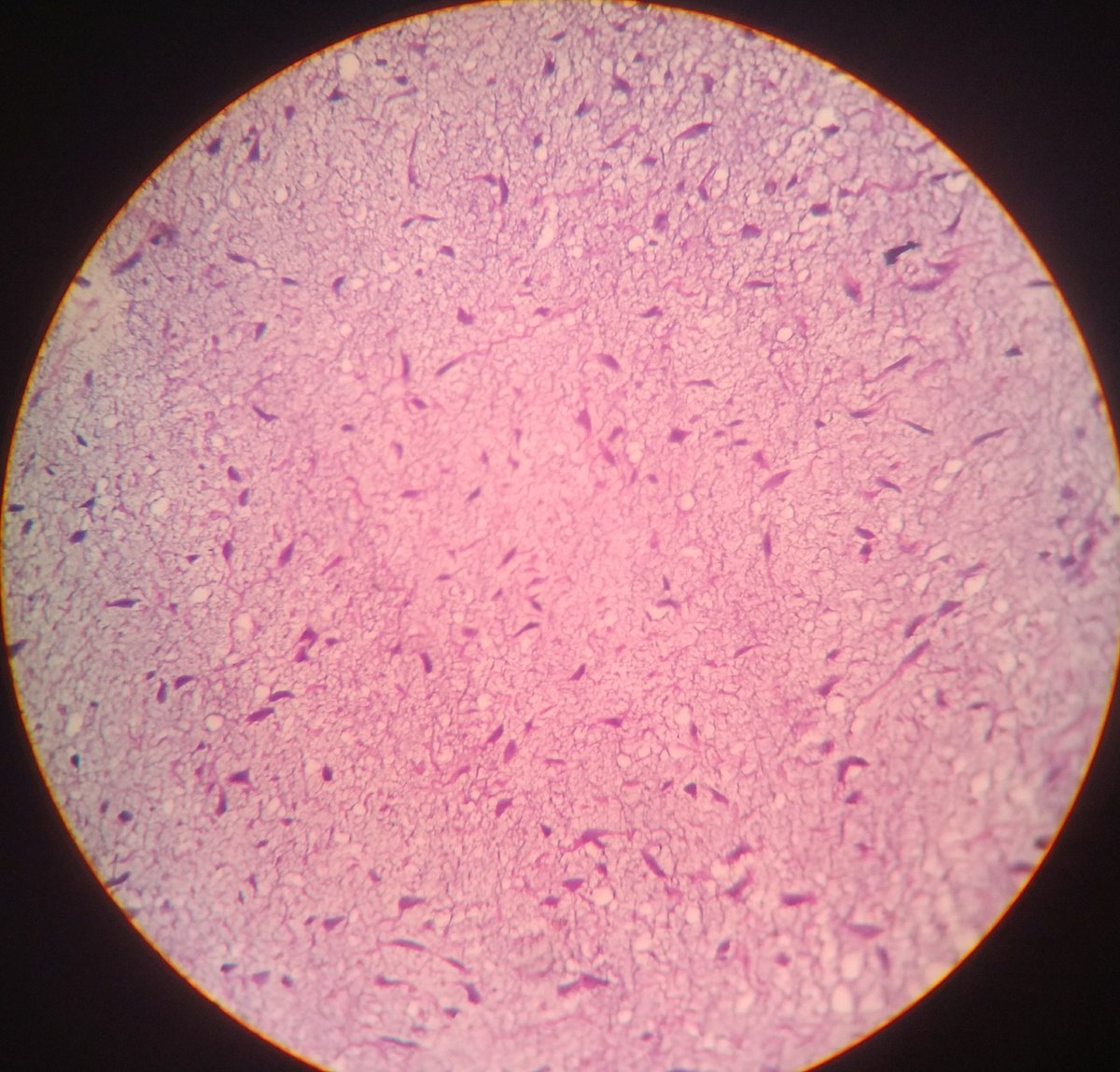 drshivakumarms's tweet photo. #DevelopingTooth, #DentalPapilla (Developing #Pulp), ectomesenchymal tissue.. https://t.co/9Iqyr9v2Cc