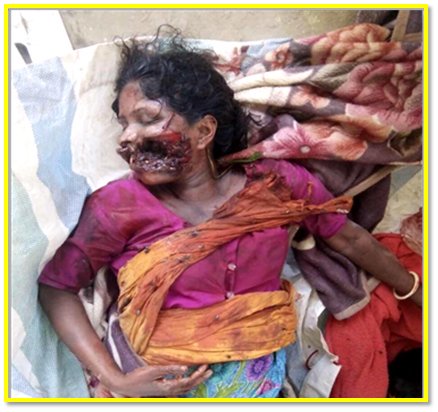 <a href="/AsYouNotWish/">Sonam Mahajan</a> In Rakhine ' Bengalis terrorist killing hindu woman .