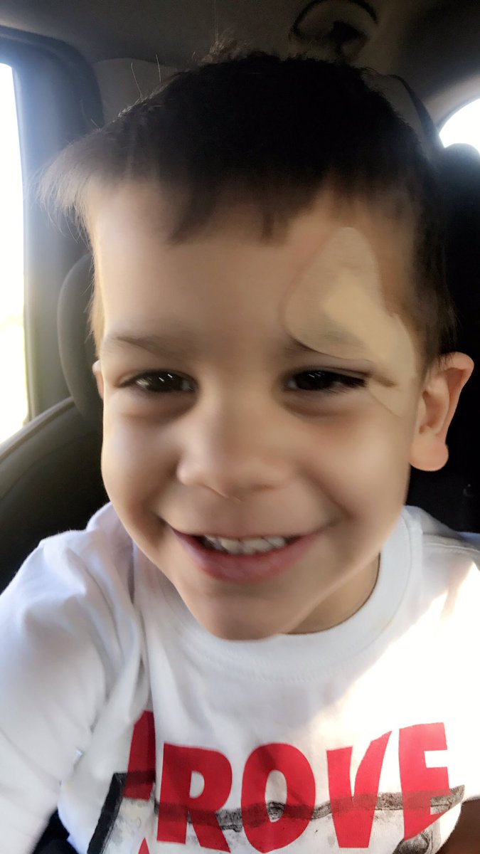 ForkEmUp's tweet photo. Mom I need bandaid. All better! #lucaspaul #firstinjury @SDFORK https://t.co/Ib2ZANv8c1