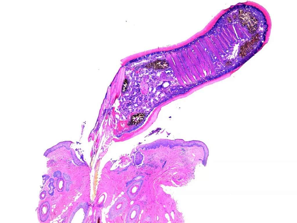 BSG_LABS's tweet photo. GORGEOUS! H&E of a tick embedded in human scalp! https://t.co/H1B8V3vZY9