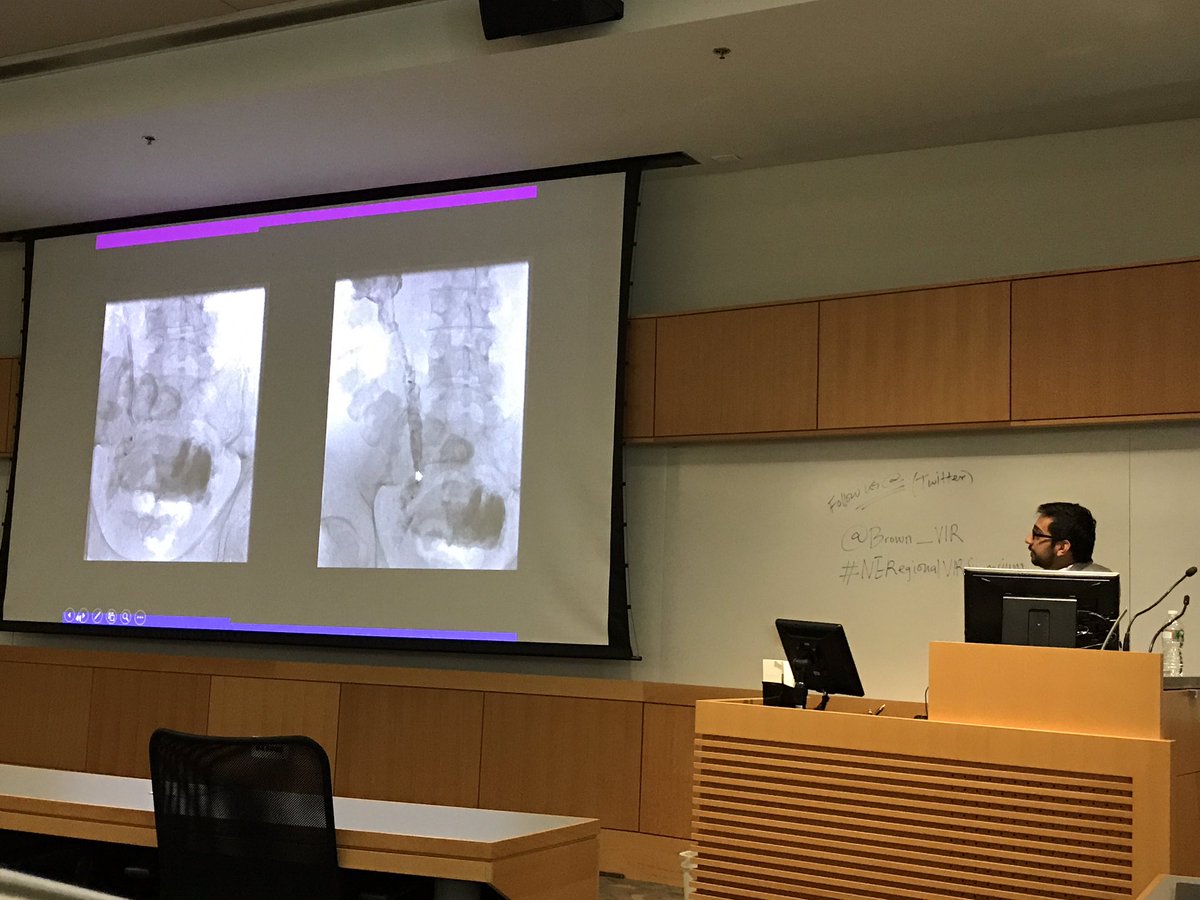 Brown_VIR's tweet photo. Colo-vesicular fistula? Feces in the bladder? VIR to save the quality of life. Dr. Mehta from @BIDMC_VIR #nomorepoop #NERegionalVIRSymposium https://t.co/XBOyivFwWi