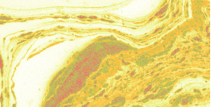 MarbleBotDaily's tweet photo. Yellow marble https://t.co/sbFKJzJrmw