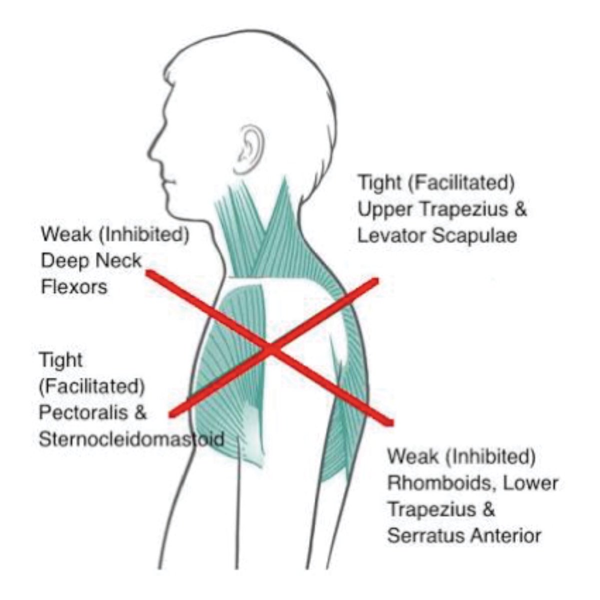Pilates_Teacher's tweet photo. Is your desk job causing muscle imbalances? #pilates #posture core #injury #pilatesteacher https://t.co/vlu32pjC17