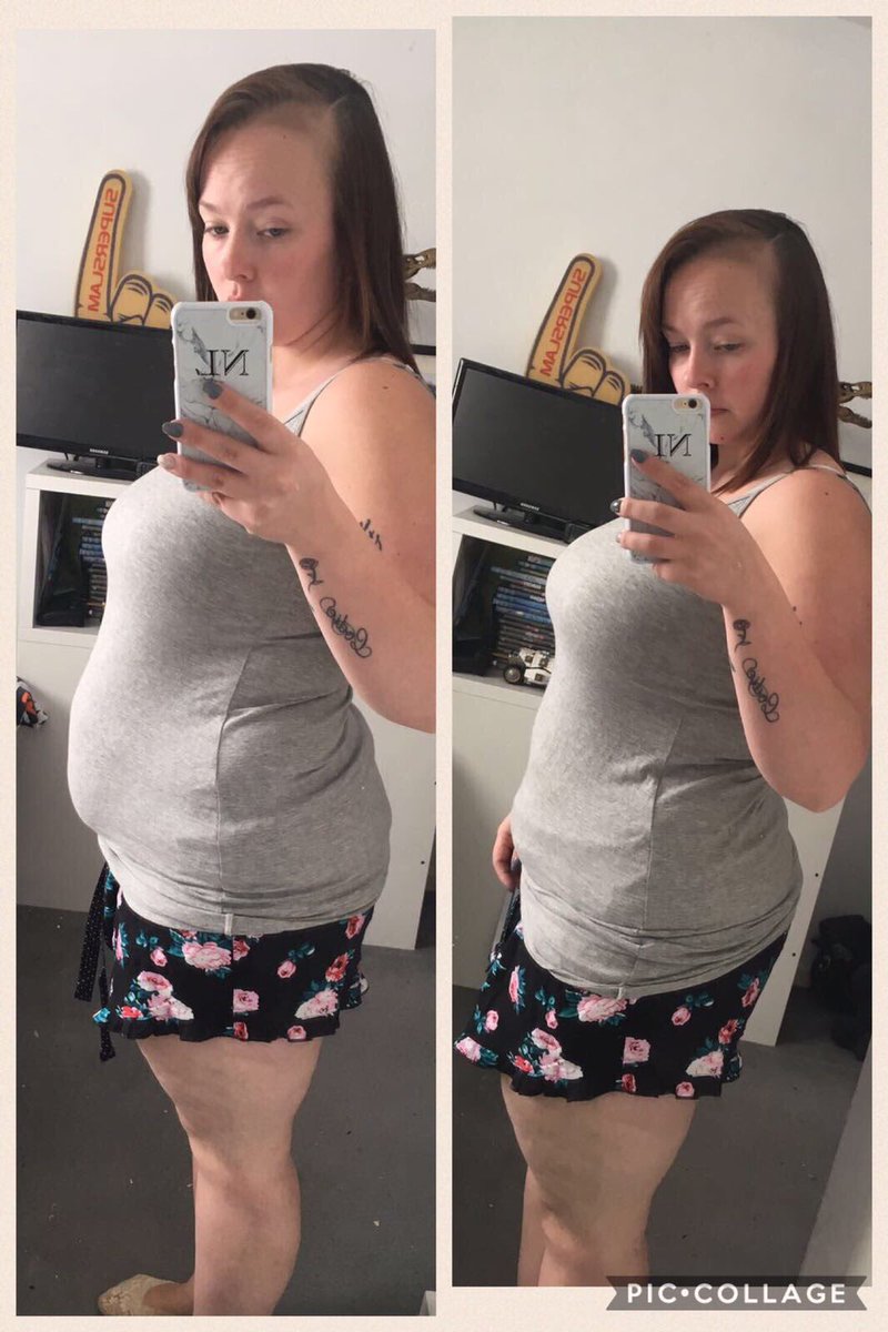 Tash_Luff's tweet image. There Is 6 Days Difference Between These Pictures.. Yes 6 Days..!! All From Having A Nutritional Breakfast. 😱