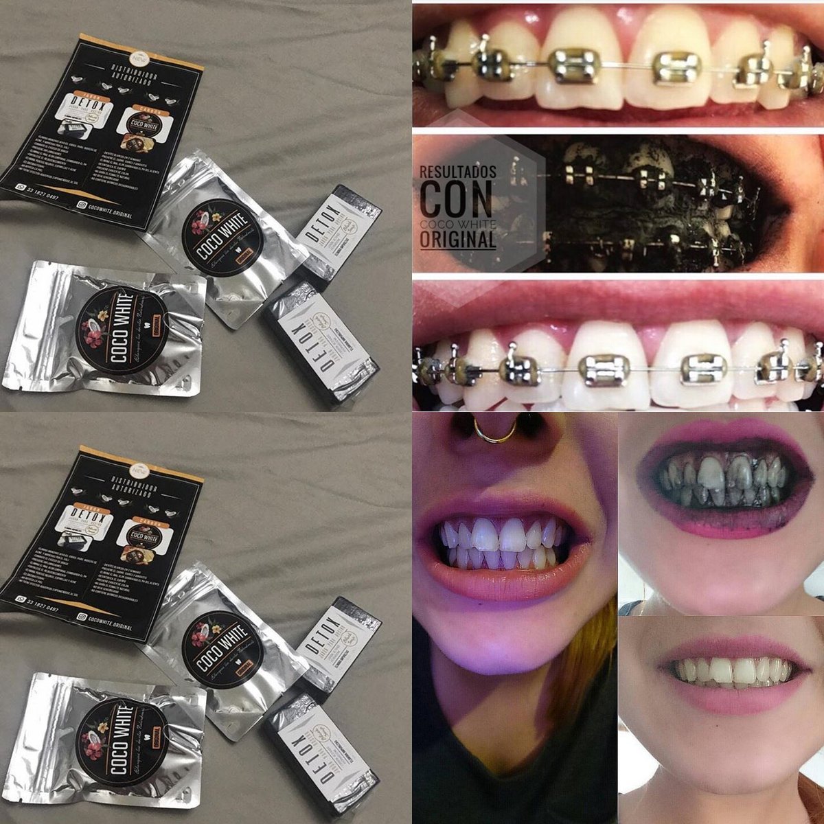 _yaareet's tweet photo. Vendo #CocoWhite para blanquear los Dientes y Jabón Detox para manchas de codo , marcas de acné y exceso de grasa etc.  Inf. Mensaje https://t.co/YsnCoZgpm5