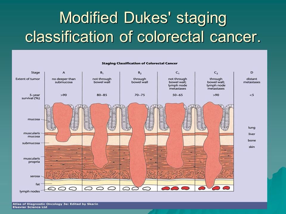 Corticoides cancer terminal