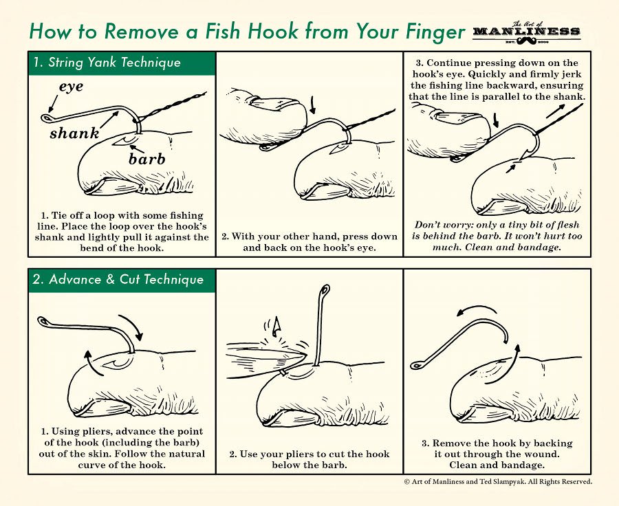 Prepper_Review's tweet photo. How to Remove a Fish Hook from Your Finger. #prepper #survival #camping #hiking https://t.co/6TSbFYpEiW