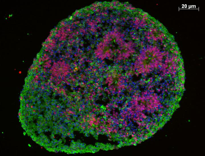 MINI-BEANS -- Human brain organoid:  proliferating cells (red), maturing neurons (green).  

pnw-b.ctx.ly/r/5sn2n