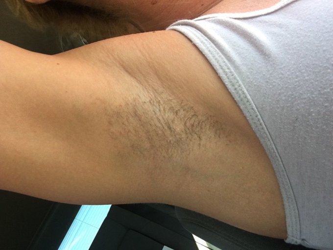 About to get this hairy underarm situation handled today😂🙌😳. https://t.co/17Mp9Lw6ZC<a href="/tag/msmarvel"class="tags"><span>#msmarvel</span></a><a href="/tag/deadpool"class="tags"><span>#deadpool</span></a>