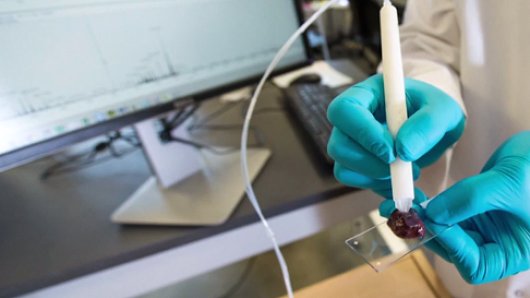 lratcn's tweet photo. A pen showed a 96 percent accuracy rate in identifying #cancer in 10 seconds https://t.co/WB5JtE06jK https://t.co/XafgtiR7Hh