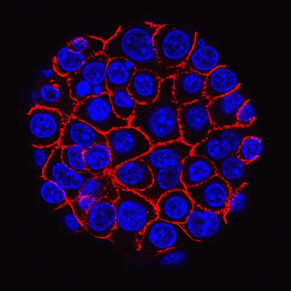 MEIK_Global's tweet photo. Pill Might Control Pancreatic Cancer, Even If It Doesn't Cure It
Forbes #biotect #cancet #newtect
https://t.co/KuMRly6m5P https://t.co/2BzfD5BYmW