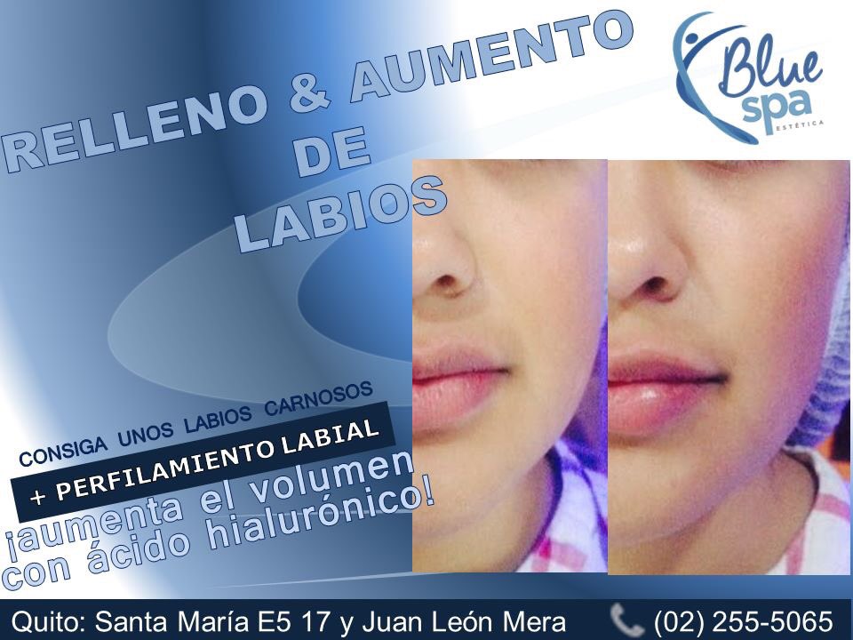 Bluespas's tweet photo. #BlueSpa
Labios carnosos más sensuales y mejor perfilados.. https://t.co/BfBXdOkwRR