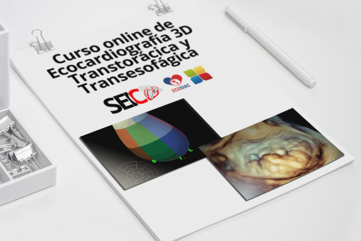 ImagenCardiaca's tweet photo. Curso Eco 3D ETT y ETE
¡ÚLTIMOS DÍAS!
Todavía puedes matricularte en este curso de #SEIC y ECOSIAC
https://t.co/7UF33Wi71Z https://t.co/IwmIBTfOCD